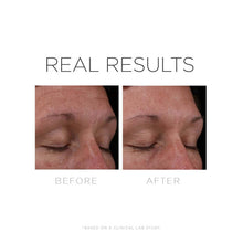 Load image into Gallery viewer, Cosmedix Serum 16 Rapid Renewal Serum